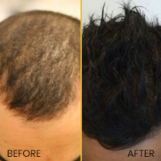 before and after treatment