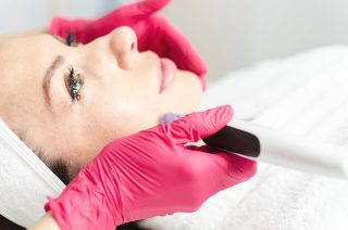 Microdermabrasion