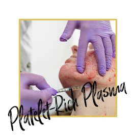 Platelet-Rich Plasma Treatment