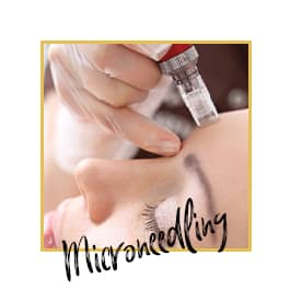 Microneedling treatment