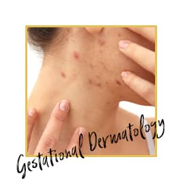 gestational dermatology treatment