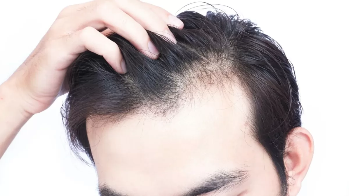 do-dermatologists-treat-hair-loss-1200x675.webp